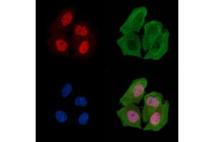 ABIN6256554 and ABIN6267250 staining Hela cells(30 min of UV treatment) by IF/ICC.