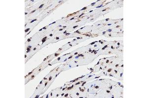 Immunohistochemistry of paraffin-embedded mouse heart using HMGB1 antibody (ABIN3059694) at dilution of 1/100 (40x lens). (HMGB1 抗体)