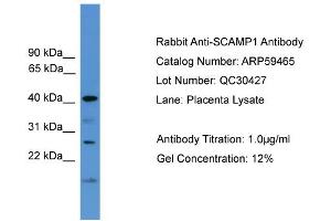 WB Suggested Anti-SCAMP1  Antibody Titration: 0. (SCAMP1 抗体  (Middle Region))