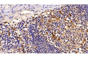 Detection of CTSS in Porcine Spleen Tissue using Polyclonal Antibody to Cathepsin S (CTSS) (Cathepsin S 抗体  (AA 115-331))