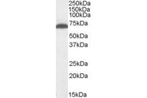 ABIN334405 (1µg/ml) staining of Mouse Brain lysate (35µg protein in RIPA buffer). (GAD 抗体  (Internal Region))
