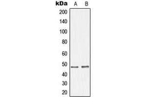 Western blot analysis of GHRH Receptor expression in SKNSH (A), LOVO (B) whole cell lysates.
