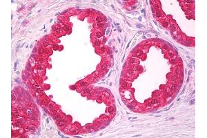 Immunohistochemistry (IHC) image for anti-Nucleolar Protein 3 (Apoptosis Repressor with CARD Domain) (NOL3) (AA 191-208) antibody (ABIN1103290)