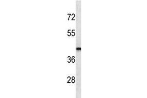 LHX2 antibody western blot analysis in MDA-MB435 lysate. (LHX2 抗体)