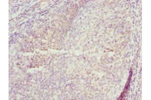Immunohistochemistry of paraffin-embedded human tonsil tissue using ABIN7173433 at dilution of 1:100 (TRIM29 抗体  (AA 309-588))