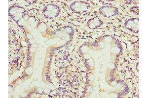 Immunohistochemistry of paraffin-embedded human small intestine tissue using ABIN7173079 at dilution of 1:100 (TMEM154 抗体  (AA 97-183))