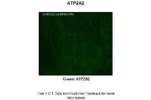 Immunohistochemistry (IHC) image for anti-ATPase, Ca++ Transporting, Cardiac Muscle, Slow Twitch 2 (ATP2A2) (C-Term) antibody (ABIN2782136)