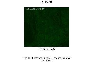 Sample Type :  Rhesus macaque spinal cord  Primary Antibody Dilution :  1:300  Secondary Antibody :  Donkey anti Rabbit 488  Secondary Antibody Dilution :  1:500  Color/Signal Descriptions :  Green: ATP2A2  Gene Name :  APLP2  Submitted by :  Timur Mavlyutov, Ph. (ATP2A2 抗体  (C-Term))
