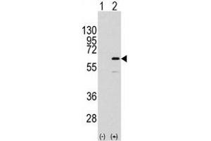 Western blot analysis of ELK1 (arrow) using rabbit polyclonal ELK1 Antibody  (R). (ELK1 抗体  (AA 361-390))