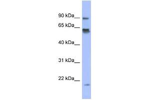 WB Suggested Anti-LRRFIP1 Antibody Titration:  0. (LRRFIP1 抗体  (N-Term))