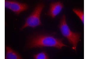 Immunofluorescence staining of methanol-fixed Hela cells using Phospho-MAPT-S262 antibody. (MAPT 抗体  (pSer262))