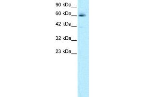 WB Suggested Anti-HCLS1 Antibody Titration:  0.