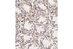 Immunohistochemical analysis of paraffin-embedded human colon tissue using C performed on the Leica® BOND RXm. (NOX1 抗体  (AA 243-271))