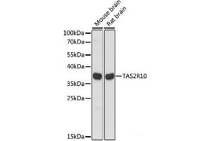 Western blot analysis of extracts of various cell lines using TAS2R10 Polyclonal Antibody at dilution of 1:1000. (TAS2R10 抗体)