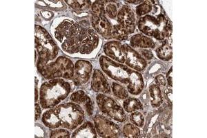 Immunohistochemical staining of human kidney with MRPL12 polyclonal antibody  shows strong cytopmasmic positivity with granular pattern in cells in tubules and cells in glomeruli. (SLC25A10 抗体)