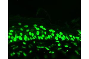 Acetylated Lysine (7F8), mouse backskin (Lysine (lys) (acetylated) 抗体)