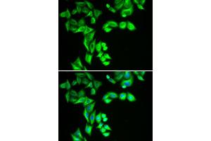 Immunofluorescence analysis of HeLa cell using STRN3 antibody. (STRN3 抗体)