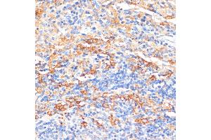 Immunohistochemistry of paraffin-embedded rat spleen using APCS antibody (ABIN3022713, ABIN3022714, ABIN3022715, ABIN1512583 and ABIN6219158) at dilution of 1:100 (40x lens). (APCS 抗体  (AA 1-223))