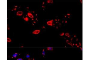 Immunofluorescence analysis of HeLa cells using CCT8 Polyclonal Antibody at dilution of 1:100 (40x lens). (CCT8 抗体)