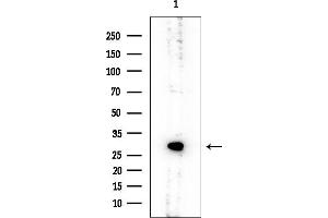 anti-Ribosomal Protein S4, Y-Linked 1 (RPS4Y1) (C-Term) antibody
