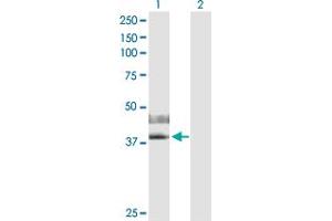 Western Blot analysis of IL2RG expression in transfected 293T cell line by IL2RG MaxPab polyclonal antibody. (IL2RG 抗体  (AA 1-369))