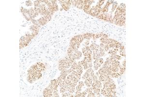 Immunohistochemistry (IHC) image for anti-Paired Box 8 (PAX8) antibody (ABIN7795602)