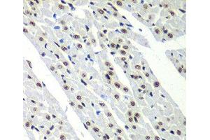 Immunohistochemistry of paraffin-embedded Rat heart using SF3B2 Polyclonal Antibody at dilution of 1:100 (40x lens). (SF3B2 抗体)