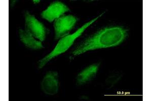Immunofluorescence of monoclonal antibody to TBC1D8 on HeLa cell. (TBC1D8 抗体  (AA 1-110))