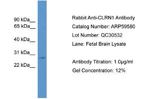 WB Suggested Anti-CLRN1  Antibody Titration: 0. (Clarin 1 抗体  (C-Term))