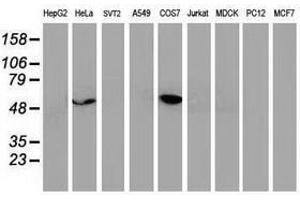 Image no. 7 for anti-Tumor Protein P53 (TP53) antibody (ABIN1499972) (p53 抗体)