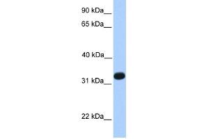 WB Suggested Anti-ACRV1 Antibody Titration: 0. (ACRV1 抗体  (N-Term))