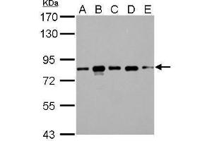 WB Image CD2AP antibody detects CD2AP protein by Western blot analysis.