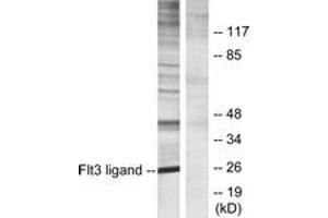Western blot analysis of extracts from Jurkat cells, using Flt3 ligand Antibody. (FLT3LG 抗体  (AA 171-220))