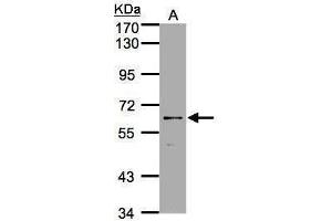 WB Image Sample(30 ug whole cell lysate) A:A431, 7. (P2RX7 抗体  (Center))
