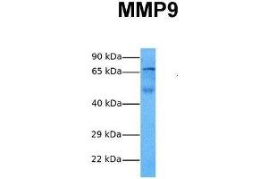 Western Blotting (WB) image for anti-Matrix Metallopeptidase 9 (Gelatinase B, 92kDa Gelatinase, 92kDa Type IV Collagenase) (MMP9) (N-Term) antibody (ABIN2777743)