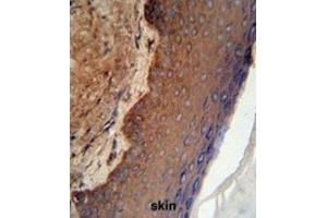Immunohistochemistry (IHC) image for anti-Keratin 9 (KRT9) antibody (ABIN3003130) (KRT9 抗体)