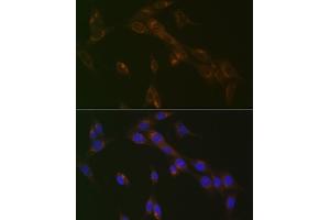 Immunofluorescence analysis of NIH-3T3 cells using RA Rabbit mAb (ABIN7269817) at dilution of 1:100 (40x lens). (RAB9A 抗体)
