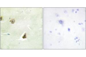 Immunohistochemistry analysis of paraffin-embedded human brain tissue, using DUSP6 Antibody. (DUSP6 抗体  (AA 61-110))