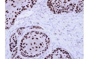 IHC-P Image Immunohistochemical analysis of paraffin-embedded Cal27 Xenograft, using NuMA , antibody at 1:100 dilution. (NUMA1 抗体  (N-Term))