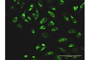 Immunofluorescence of purified MaxPab antibody to MTDH on HeLa cell. (MTDH 抗体  (AA 1-582))
