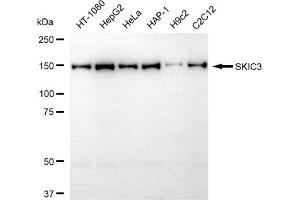 anti-SKIC3 antibody