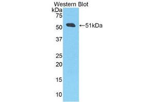 Western Blotting (WB) image for anti-Amyloid beta (A4) Precursor Protein (APP) (AA 672-711) antibody (ABIN3207377) (APP 抗体  (AA 672-711))