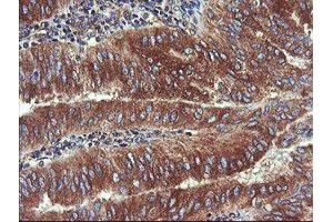 Image no. 5 for anti-Ubiquitin-Conjugating Enzyme E2, J1, U (UBE2J1) antibody (ABIN1501637)