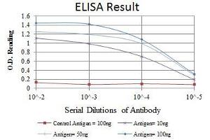 Red: Control Antigen (100 ng), Purple: Antigen (10 ng), Green: Antigen (50 ng), Blue: Antigen (100 ng), (MSI2 抗体)