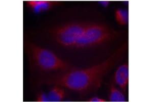 Image no. 1 for anti-Synuclein, alpha (SNCA) (AA 131-135) antibody (ABIN401570) (SNCA 抗体  (AA 131-135))