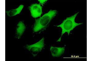 Immunofluorescence of monoclonal antibody to FASN on HeLa cell. (Fatty Acid Synthase 抗体  (AA 1-439))