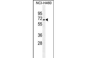 ZSCAN5B Antibody (C-term) (ABIN655366 and ABIN2844923) western blot analysis in NCI- cell line lysates (35 μg/lane). (ZSCAN5B 抗体  (C-Term))