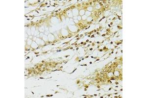 Immunohistochemistry of paraffin-embedded human stomach using ADAR antibody.