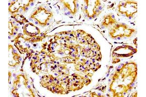 Immunohistochemistry (IHC) image for anti-Actin, alpha 1, Skeletal Muscle (ACTA1) antibody (ABIN7127272)
