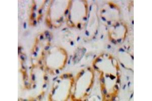 Used in DAB staining on fromalin fixed paraffin-embedded Kidney tissue (PKN1 抗体  (AA 615-874))